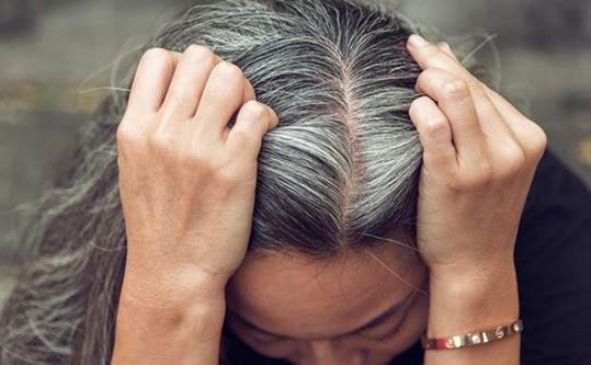 Người trẻ tuổi có tóc bạc sớm là bệnh gì? Cách cải thiện tình trạng này ra sao?